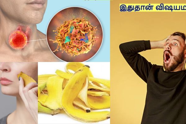 ஆச்சரியமான விஷயங்கள்!..வாழைப் பழத் தோலில் இவ்வளவு நன்மைகளா?…
